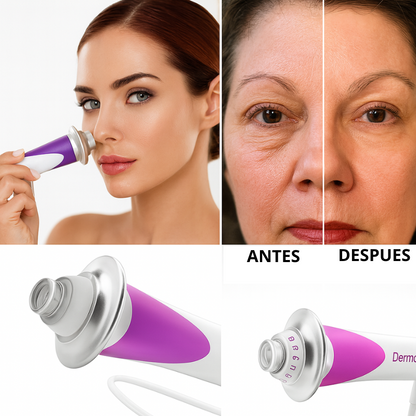 DermaWand Pro™: Lifting y tonificador facial Generic