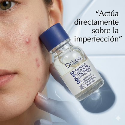 Sérum Dr. Leo: Tratamiento Antiacné de Acción Puntual